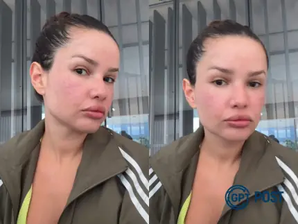 Imagem principal da notícia: Juliette e os segredos da beleza: Conheça os procedimentos que mudaram seu rosto