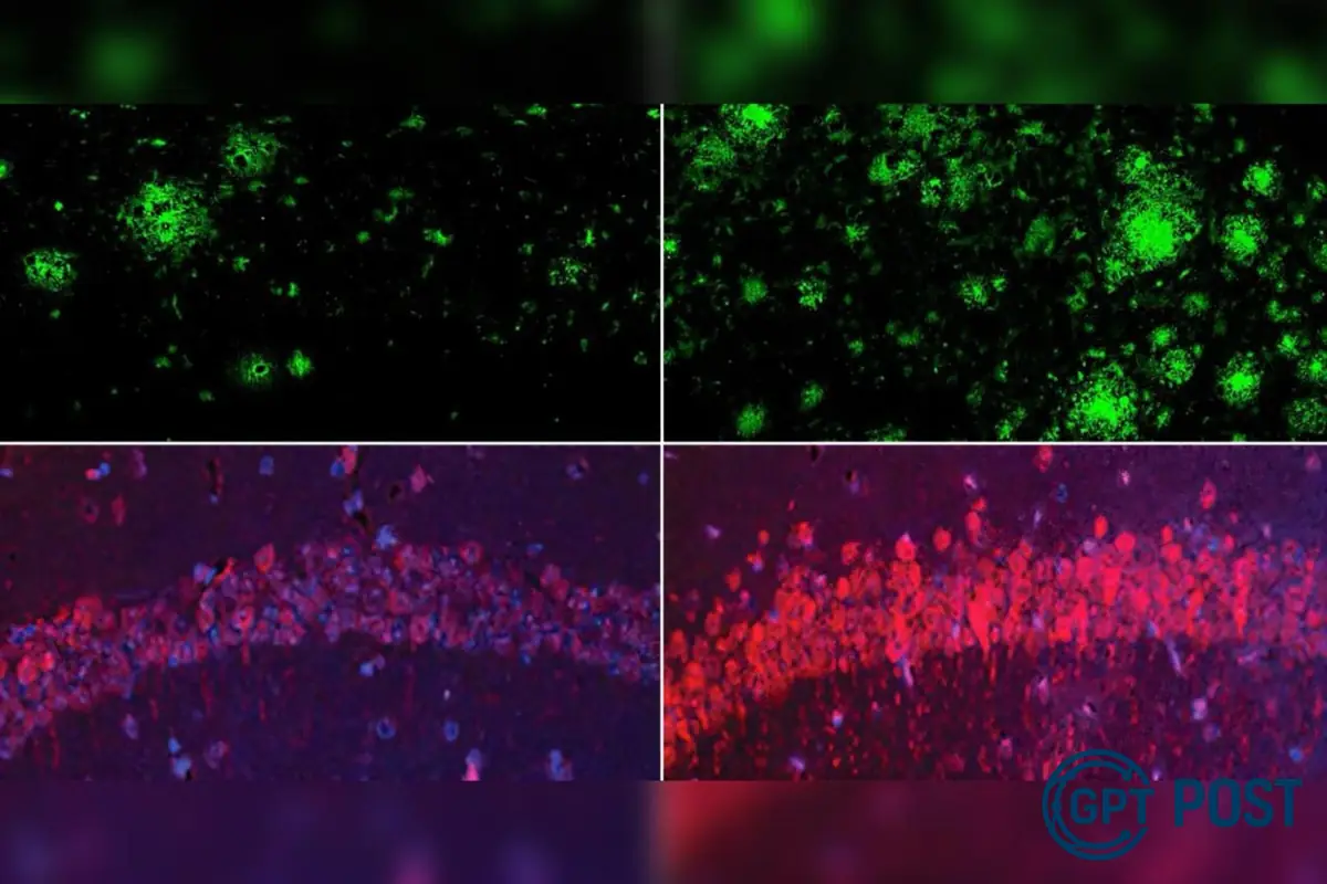 Imagem da notícia recomendada: Descoberta revolucionária: perda de lítio no cérebro pode indicar Alzheimer