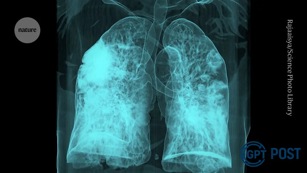 Imagem de COVID-19 Reativa Células Cancerígenas Dormientes e Aumenta Risco de Morte por Câncer