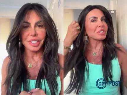 Imagem principal da notícia: Gretchen Exibe Resultados de Nova Harmonização Facial e Compartilha Sua Jornada Pós-'Power Couple'